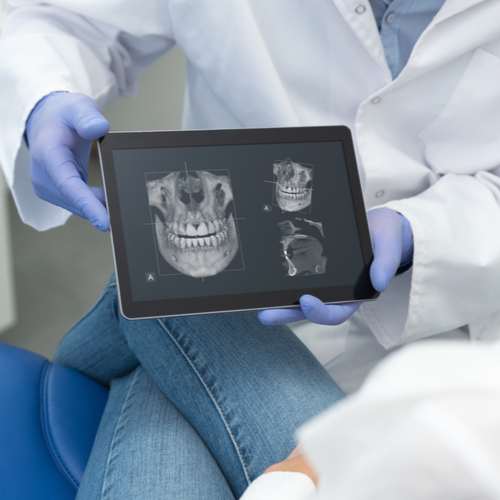 Dentist showing teeth x-ray